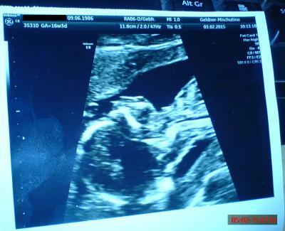 Bild zu Pränatale Diagnostik und krank = Angst - Forum für Juli - Mamis