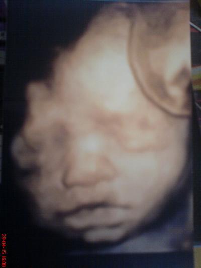 Bild zu Update meiner SS :) - Forum für Juli - Mamis