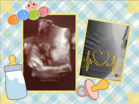 Bild zu nur noch 50 Tage !!! der Termin rückt näher - Forum für Juli - Mamis
