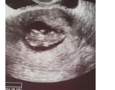 Bild zu Wie versprochen Update @mamanoel - Forum für Juli - Mamis