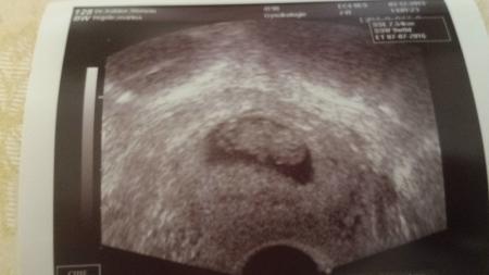 Bild zu Zurück vom FA :-) - Forum für Juli - Mamis