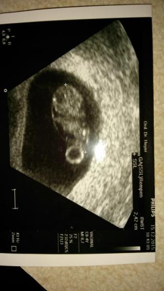 Bild zu FA-Termin der zweite :) - Forum für Juli - Mamis