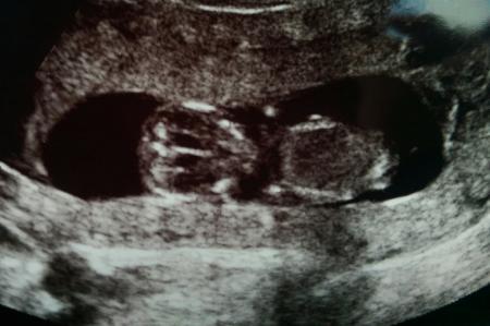 Bild zu ich glaub ich bekomme einen Alien ... - Forum für Juli - Mamis