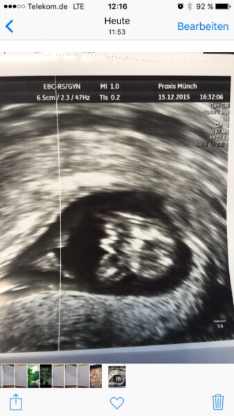 Bild zu Frage zum ultraschallbild - Forum für Juli - Mamis