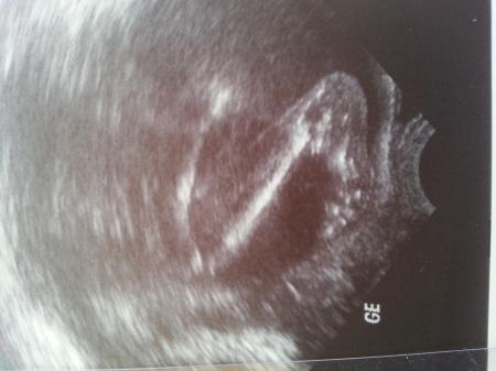 Bild zu haben es dann auch mal geschafft ^^ - Forum für Juli - Mamis