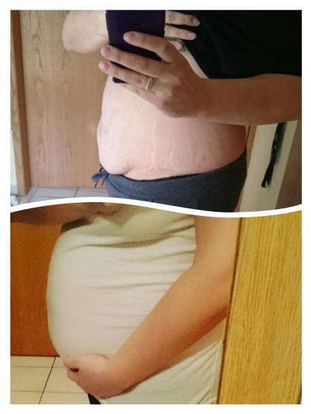 Bild zu Bauch weg kennt das noch wer - Forum für Juli - Mamis