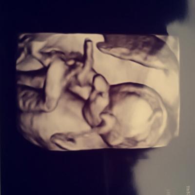Bild zu Zurück vom 3d Ultraschall + Outing! - Forum für Juli - Mamis