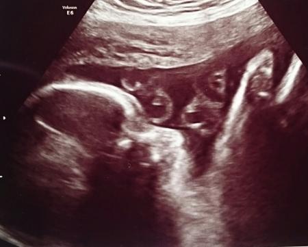 Bild zu Zurück vom 3US - Forum für Juli - Mamis