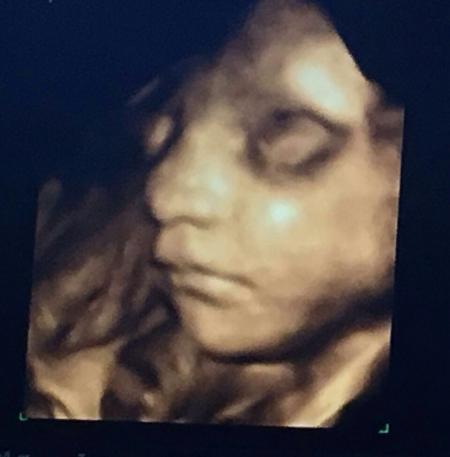 Bild zu zurück vom FA und verliebt :) - Forum für Juli - Mamis