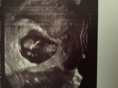 Bild zu Gestern Glücksgefühle pur! - Forum für Juli - Mamis