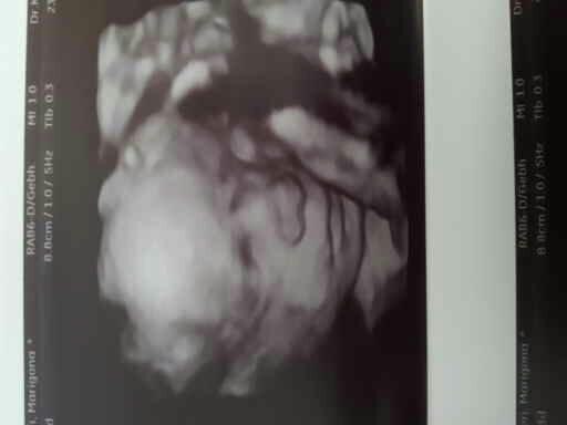 Bild zu 3D bilder 💗💗💗 - Forum für Juli - Mamis