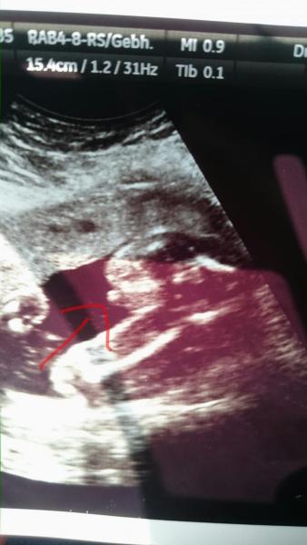 Bild zu Brauche eure Meinung... - Forum für Juli - Mamis