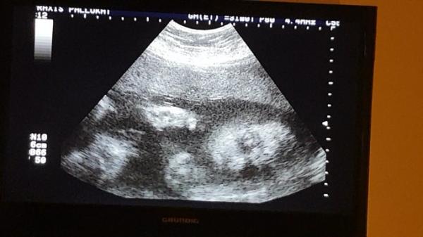 Bild zu Ultraschallbilder + Woche + Geschlecht ♡ - Forum für Juli - Mamis