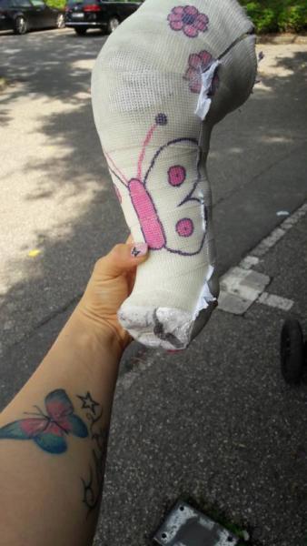 Bild zu Der Gips ist ab - Forum für Juli - Mamis