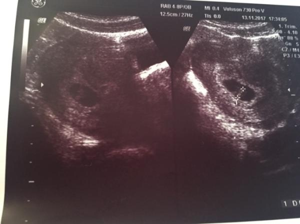 Bild zu Der erste fa Termin - Forum für Juli - Mamis