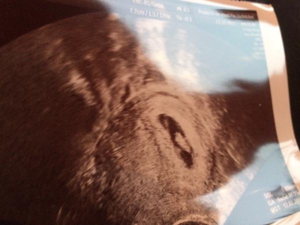 Bild zu Meine kleine Bohne - Forum für Juli - Mamis
