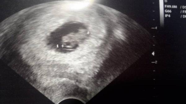 Bild zu alles gut :) - Forum für Juli - Mamis