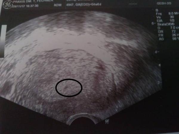 Bild zu 1 Frauenarzt Termin - Forum für Juli - Mamis