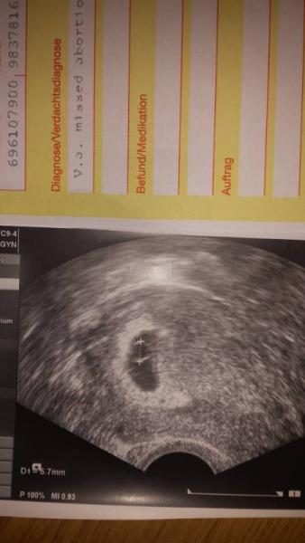 Bild zu War beim Fa... Keine guten Neuigkeiten  - Forum für Juli - Mamis