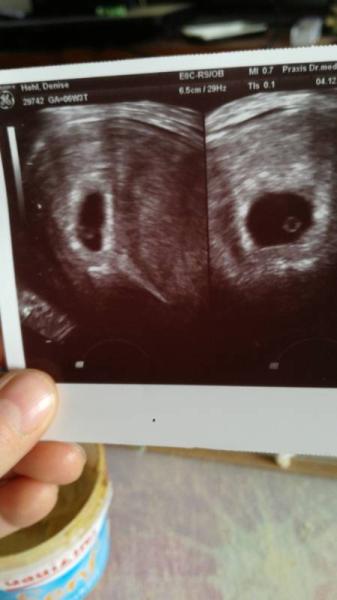 Bild zu Hallo heute war mein erster Fa Termin - Forum für Juli - Mamis