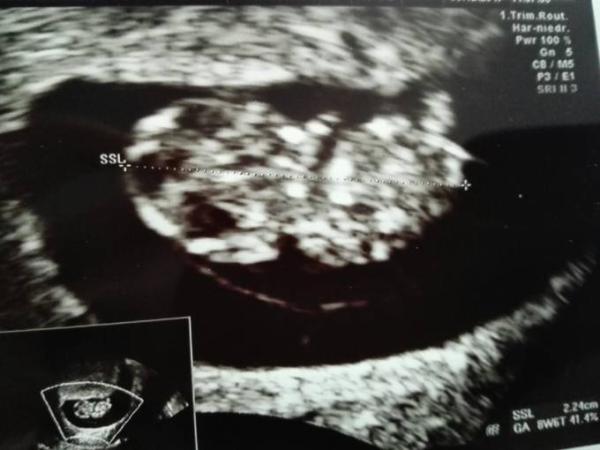 Bild zu Würmli geht es gut vs Unzufriedenheit beim Doc - Forum für Juli - Mamis