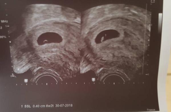 Bild zu Besuch beim FA  - Forum für Juli - Mamis