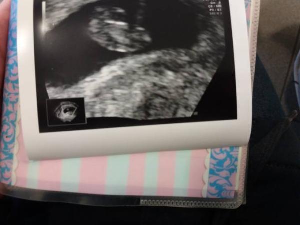 Bild zu Zurück vom Termin 😍😍😍😍 - Forum für Juli - Mamis