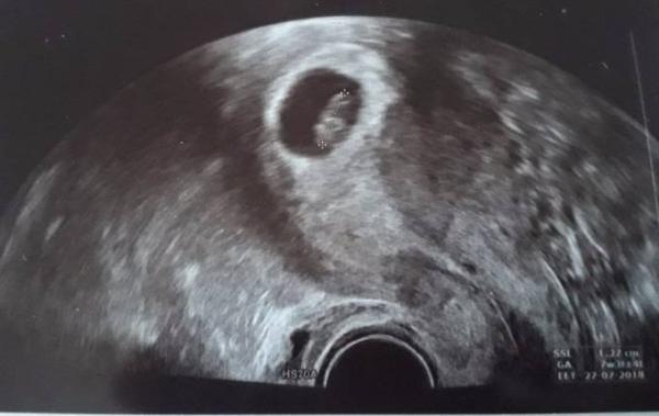 Bild zu Zurück von Zahn und Frauenarzt  - Forum für Juli - Mamis
