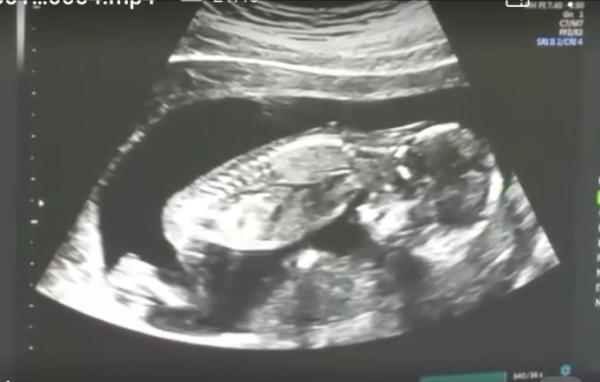 Bild zu Auch zurück vom FA... - Forum für Juli - Mamis