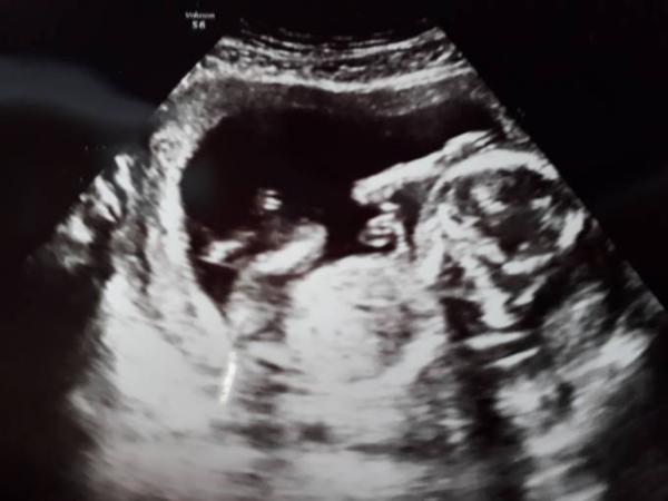 Bild zu Zurück vom FA und ganz happy  - Forum für Juli - Mamis