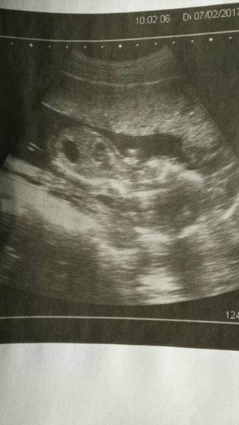Bild zu Vorab Ultraschall - Forum für Juli - Mamis