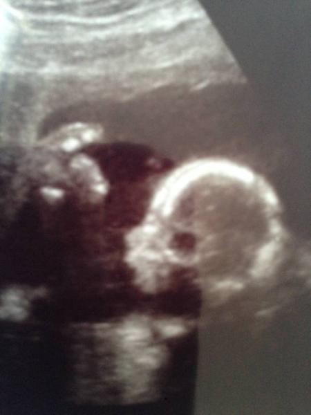 Bild zu 3D Ultraschall und Outing! - Forum für Juli - Mamis