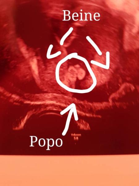 Bild zu Halbzeit, Screening und krank... - Forum für Juli - Mamis