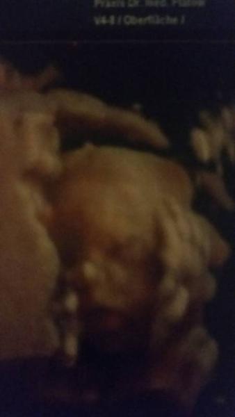 Bild zu Oh wie wunderschön...2. Ultraschall U - Forum für Juli - Mamis