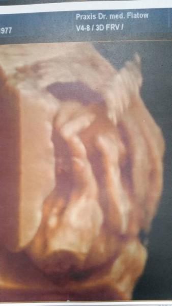 Bild zu Langeweile...Lust auf Geschlecht raten? 😊 - Forum für Juli - Mamis