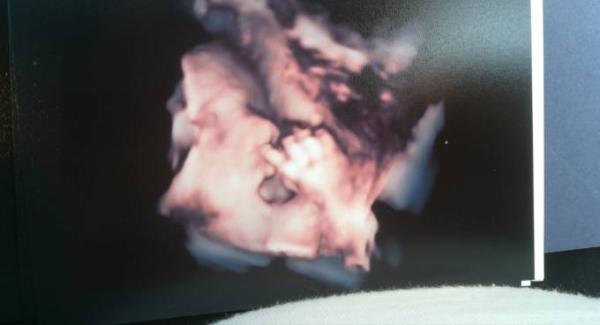 Bild zu Unser Baby... - Forum für Juli - Mamis