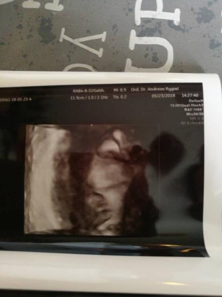 Bild zu zurück vom Frauenarzt mit hiobsbotschaft - Forum für Juli - Mamis