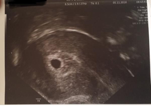 Bild zu Zurück von doc - Forum für Juli - Mamis