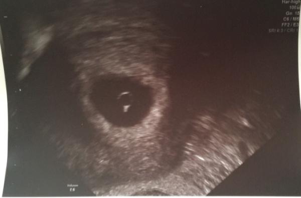 Bild zu Zurück vom Doc - Forum für Juli - Mamis
