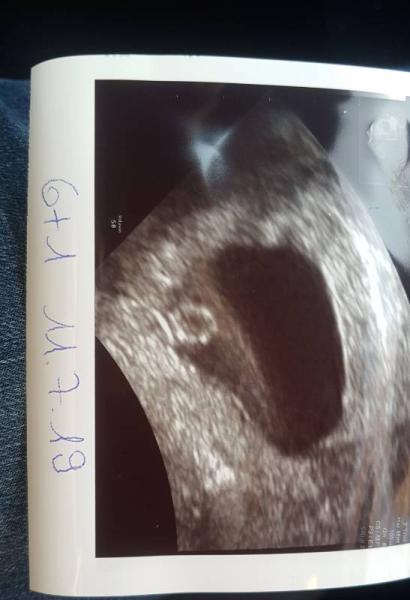 Bild zu 1. Ultraschall - Forum für Juli - Mamis