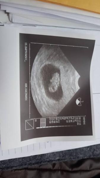 Bild zu Der Entbindungstermin bleibt 😁 - Forum für Juli - Mamis