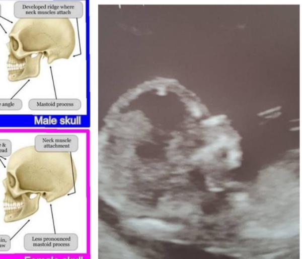Bild zu Skull Theorie - eure Tendenz? - Forum für Juli - Mamis