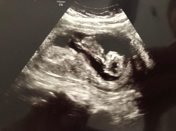 Bild zu Zurück von Arzt - Forum für Juli - Mamis