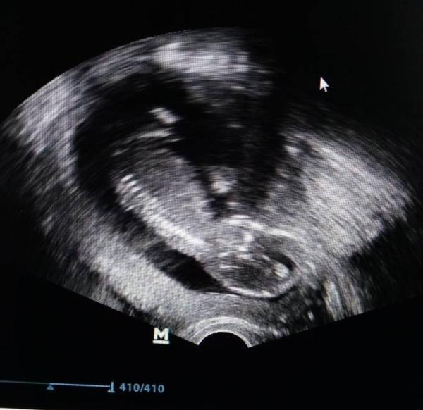 Bild zu Baby geht es super - Forum für Juli - Mamis