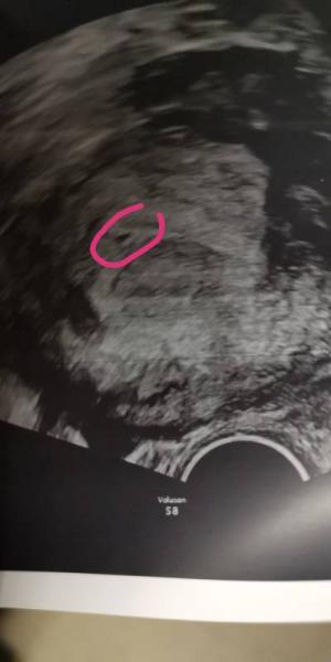 Bild zu Zurück vom Frauenarzt - Forum für Juli - Mamis