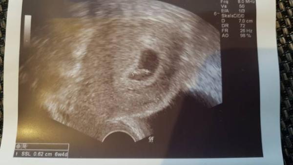 Bild zu Darf ich vorstellen... - Forum für Juli - Mamis