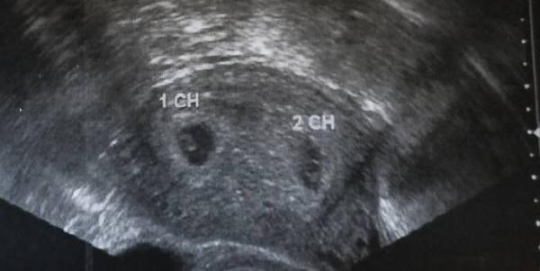 Bild zu Bericht vom US - Forum für Juli - Mamis
