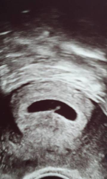 Bild zu Hallo krümelchen - Forum für Juli - Mamis