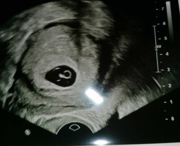 Bild zu Etwas beunruhigt - Forum für Juli - Mamis