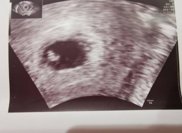 Bild zu 1. Frauenarzt Termin - Forum für Juli - Mamis